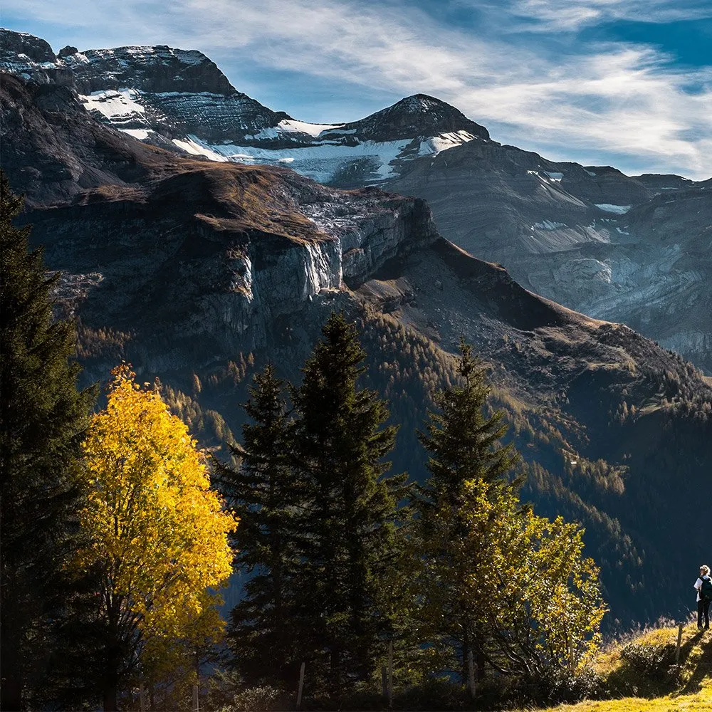 What is hyperhidrosis